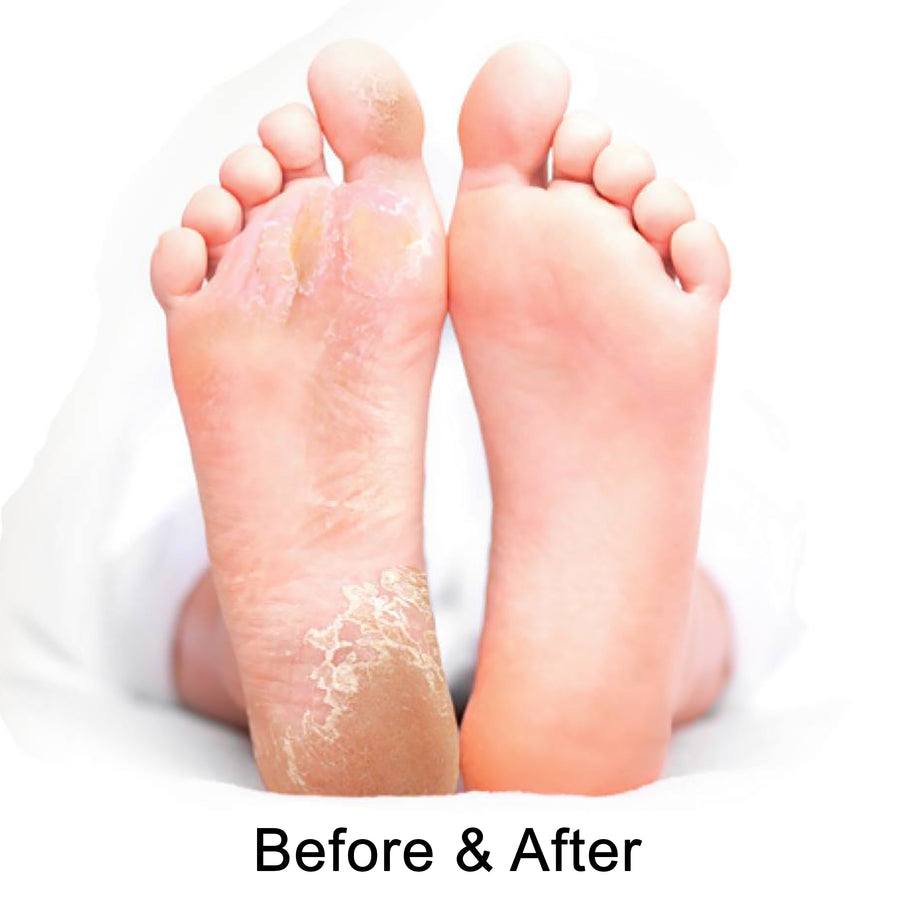 Baby Foot Exfoliation Peel - Lavender Scented