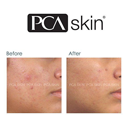 Blemish Control Bar PCA